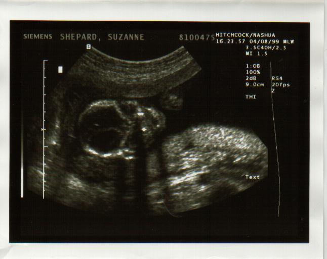 baby0003.jpg