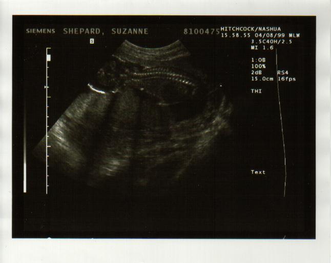 baby0011.jpg