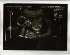 baby0001