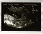 baby0002