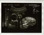 baby0003