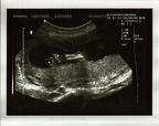 baby0004