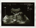 baby0005