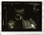 baby0006