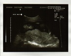 baby0009