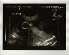 baby0010