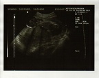 baby0011
